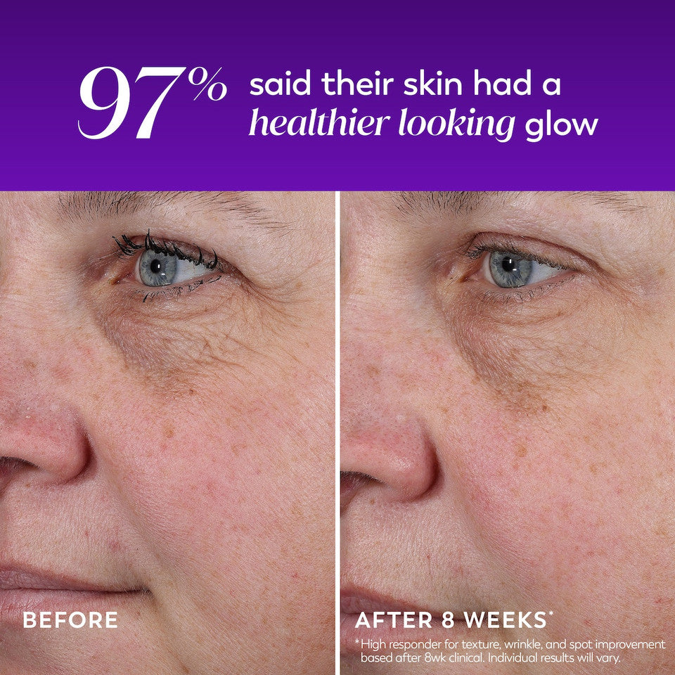 Regenerist Resurfacing Peel Night Treatment - Image 11