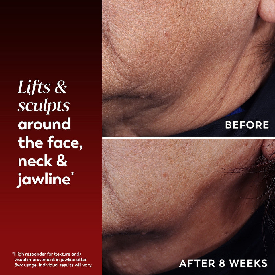 Regenerist Face & Neck Lifting Treatment - Image 2