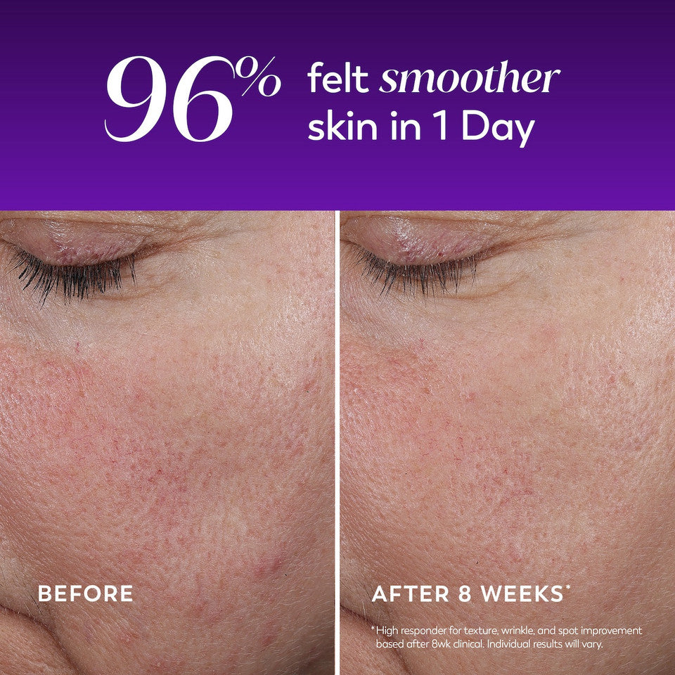 Regenerist Wrinkle Correcting Night Treatment - Image 5
